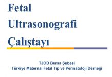 Fetal Ultrasonografi Çalıştayı | 18 Kasım 2018 | Bursa